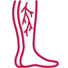 illustration of legs with veins